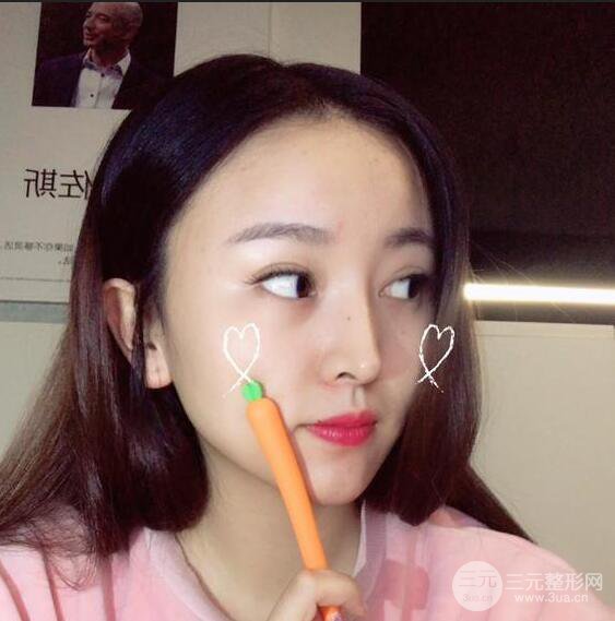 珠海陸達(dá)彭劍隆鼻整形術(shù)前術(shù)后對比