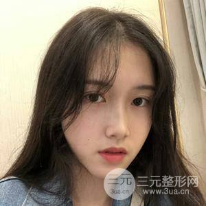 北京藝星仇侃敏肋軟骨隆鼻真實(shí)果對(duì)比圖