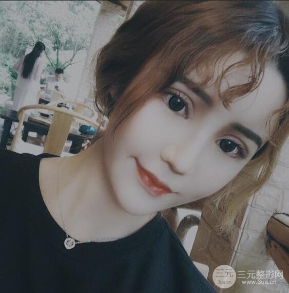 原來我和baby的距離只差一個網(wǎng)紅套餐，“雙眼皮+自體脂肪填充+豐唇”術后真人反饋