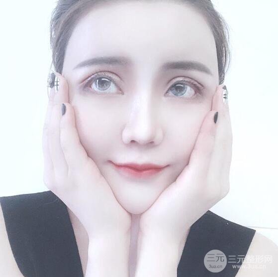 原來我和baby的距離只差一個網(wǎng)紅套餐，“雙眼皮+自體脂肪填充+豐唇”術后真人反饋