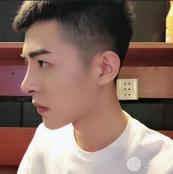 肋軟骨隆鼻三個(gè)月恢復(fù)記錄反饋，想變帥怎能沒有高挺的鼻子！