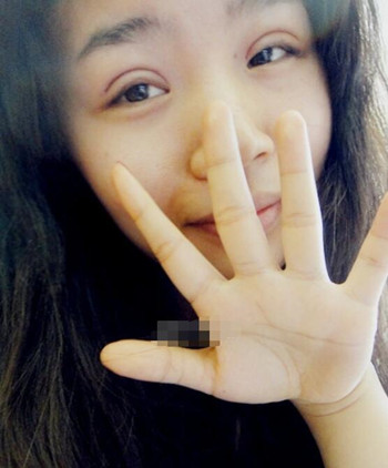 你們來看看藝美門智和做的埋線雙眼皮，瞬間變大眼美女