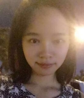 全切雙眼皮+去脂肪，終于擺脫小眼睛了