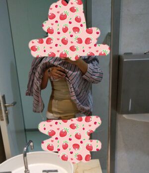 腰腹吸脂后腰線好看太多，肚子也小了