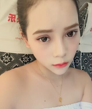 尹度龍醫(yī)生做的雙眼皮無比的自然美麗