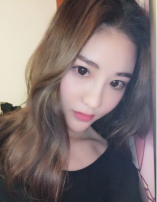在隆鼻整形之后終于有了超精致的鼻子，尹度龍做的喲