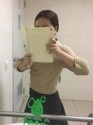 腰腹吸脂減肥果很好，恢復(fù)圖分享
