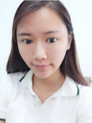 自體脂肪面部填充后恢復(fù)，成活率還蠻高的