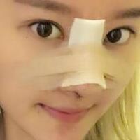 硅膠假體隆鼻過程和隆鼻前后圖片，真實(shí)案例分享