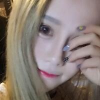 玻尿酸填充臥蠶果對(duì)比圖，很滿意
