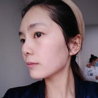 做完光子嫩膚恢復(fù)圖片和過(guò)程分享，光子嫩膚價(jià)格3800元