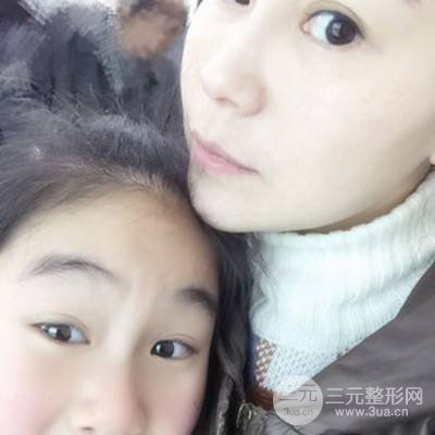武漢美侖陳遠海自體脂肪填充全臉案例，附上前后對比圖片