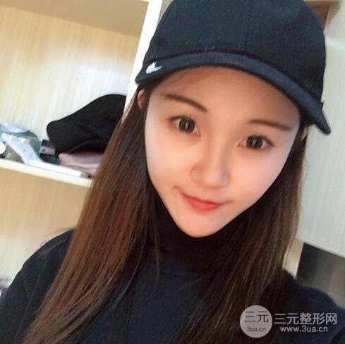 下頜角磨骨整形全過程分享，附上術后恢復照片~