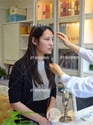 江蘇施爾美自體脂肪填充面部案例，前后對(duì)比圖分享