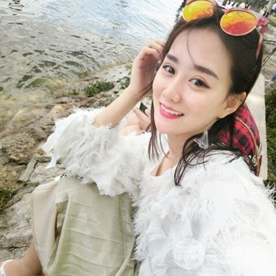 廣州韓妃李光琴隆鼻失敗修復(fù)前后對(duì)比圖分享！