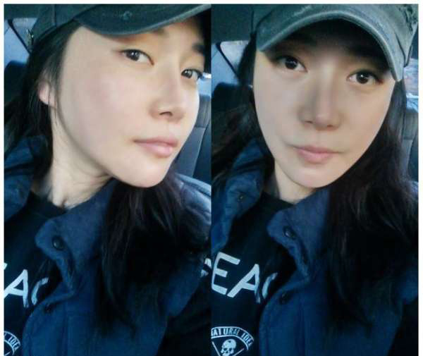 柳大烈給我做的改臉型手術 求圍觀!