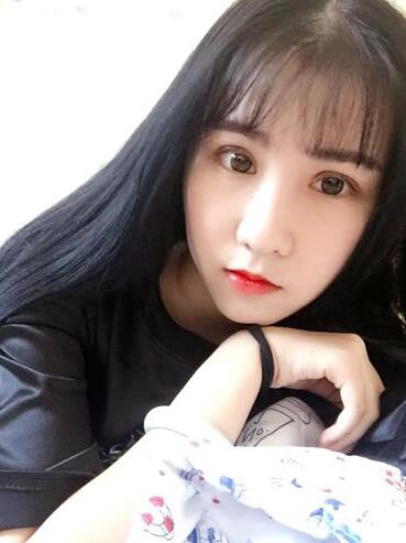 切的雙眼皮90天恢復(fù)過程圖