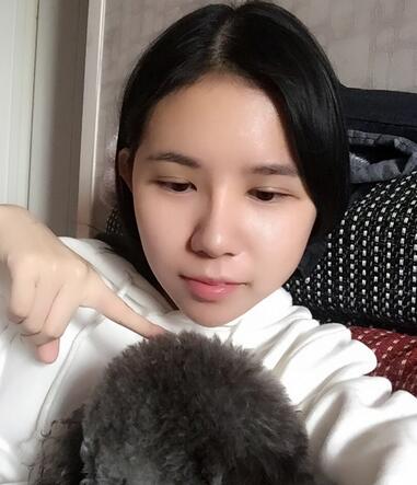 自體脂肪填充恢復日志 自體脂肪填充太陽穴+額頭