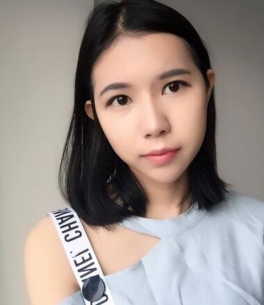 自體脂肪填充恢復日志 自體脂肪填充太陽穴+額頭