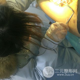 大腿抽脂果好到不行、瘦十厘米不是問題