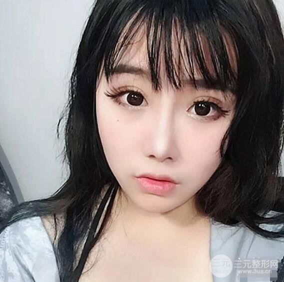 合肥壹加壹甘泉涌軟骨隆鼻前后對(duì)比圖|內(nèi)附真人案例恢復(fù)前過程