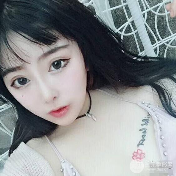 合肥壹加壹甘泉涌軟骨隆鼻前后對(duì)比圖|內(nèi)附真人案例恢復(fù)前過程