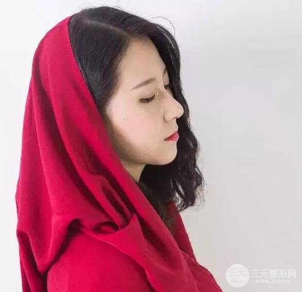 北京藝星仇侃敏微創(chuàng)肋軟骨隆鼻前后對比圖 術(shù)后一個(gè)月的恢復(fù)狀況