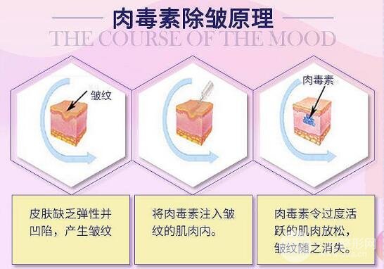 去皺多少錢