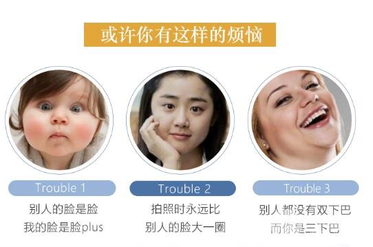 面部吸脂手術(shù)費用多少？2020年收費情況盤點~