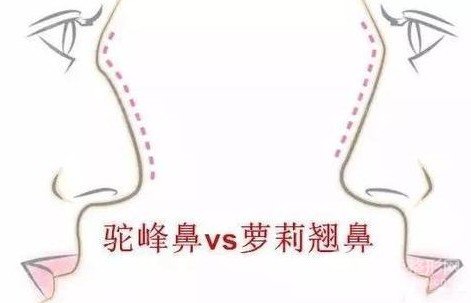 駝峰鼻修復精油