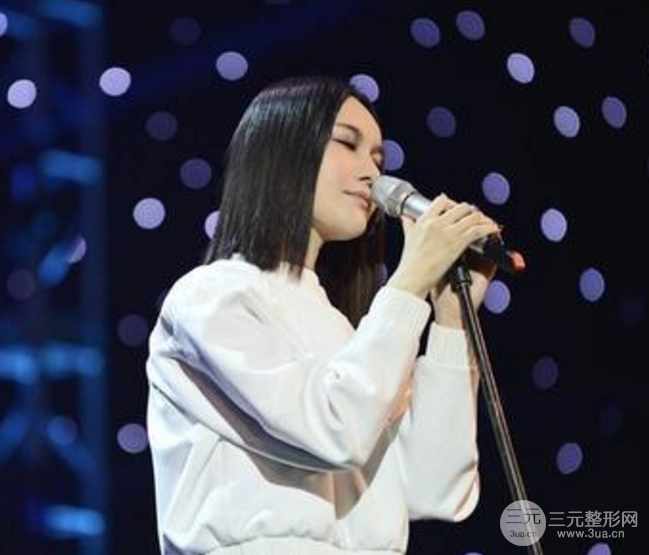 尚雯婕   整容