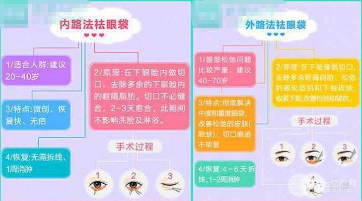怎樣才能基本去除眼袋