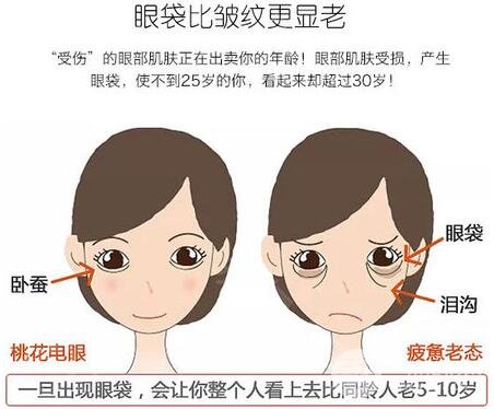 怎樣才能基本去除眼袋