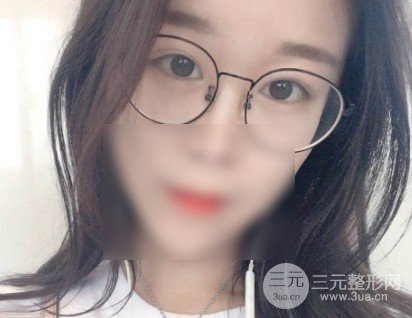 微創(chuàng)去眼袋**嗎