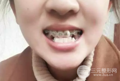 邵陽雅貝康口腔醫(yī)院價目表