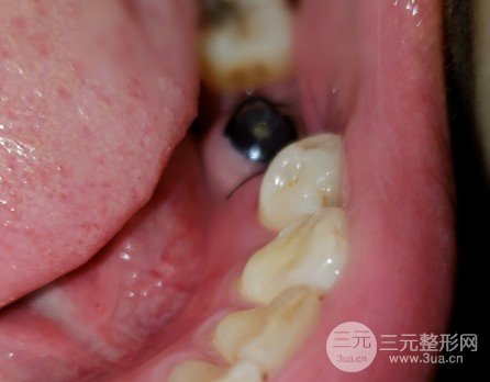 邵陽雅貝康口腔醫(yī)院價目表