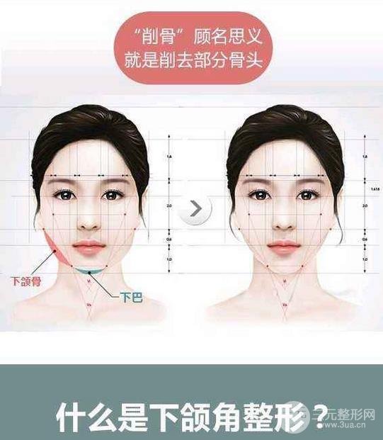 國字臉削骨價(jià)格一般多少錢？手術(shù)注意事項(xiàng)以及案例圖分享~