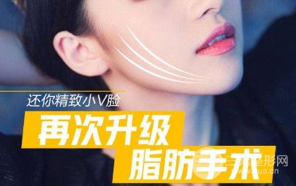 面部吸脂會反彈嗎