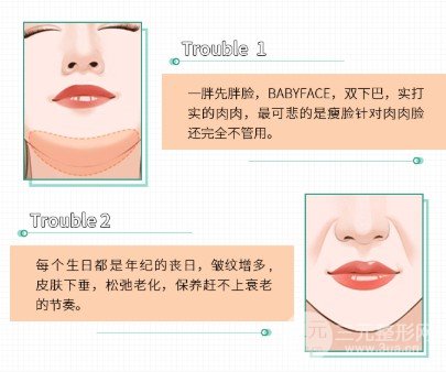面部吸脂會反彈嗎