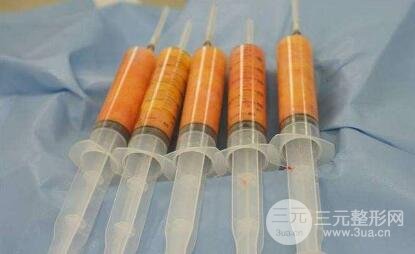 脂肪吸收率取決于這些因素
