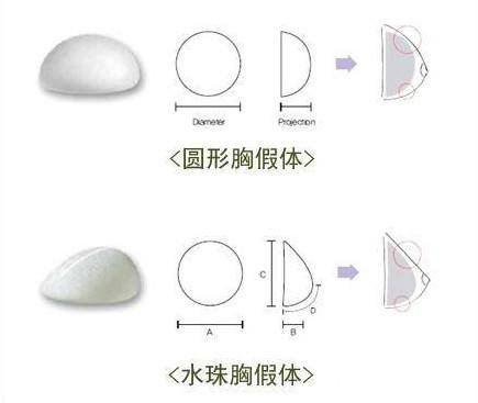 假體隆胸前應(yīng)了解哪些事?