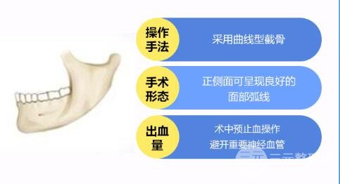 磨下頜角手術(shù)價(jià)格