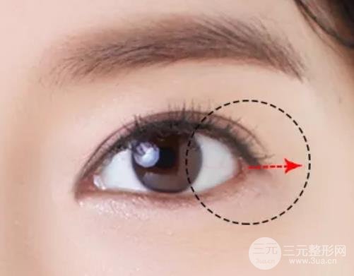 開(kāi)眼角禁忌人群