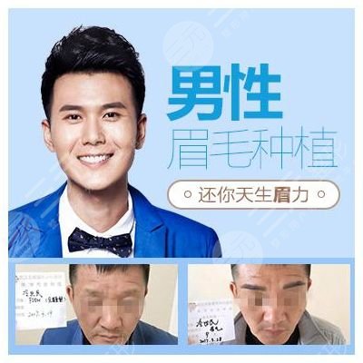 種植眉毛
