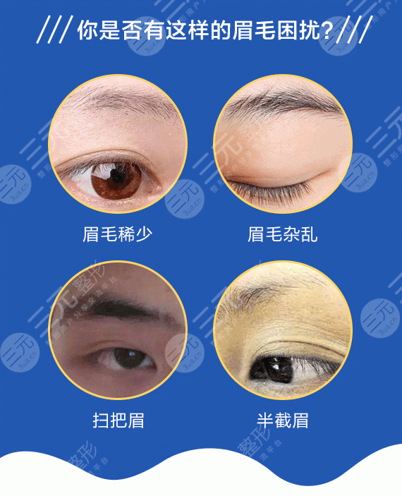 種植眉毛