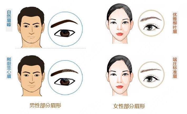 種植眉毛