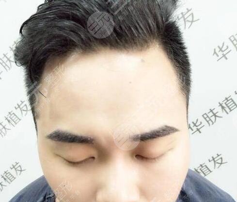 種眉毛果圖