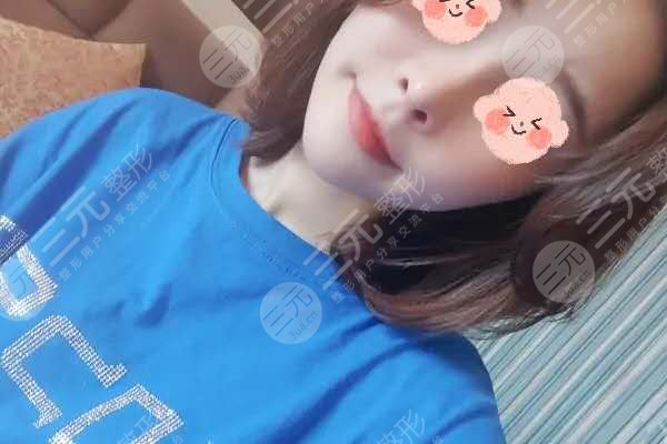 上海九院隆鼻價目表2020大公開，還有漂亮的隆鼻果分享哦！