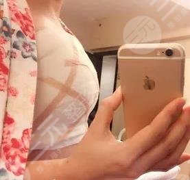 西安西京醫(yī)院整形美容科價目表及用戶整形經(jīng)歷分享