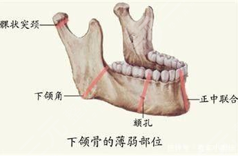 下頜骨手術(shù)需要多少錢